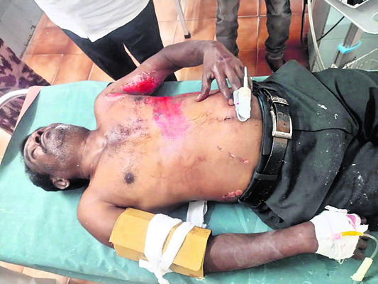 వ్యక్తి అదృశ్యం1