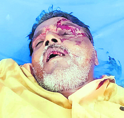 ఎదురెదురుగా బైక్‌ల ఢీ 1