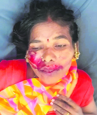 ఎదురెదురుగా బైక్‌ల ఢీ 2