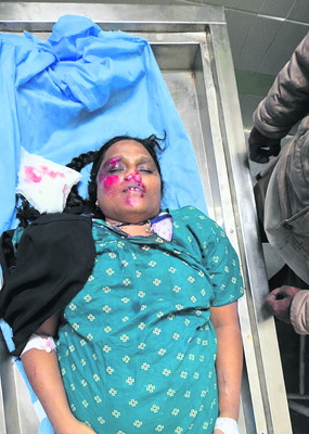 సేంద్రియ ఎరువులకు ప్రాధాన్యత ఇవ్వాలి 
1