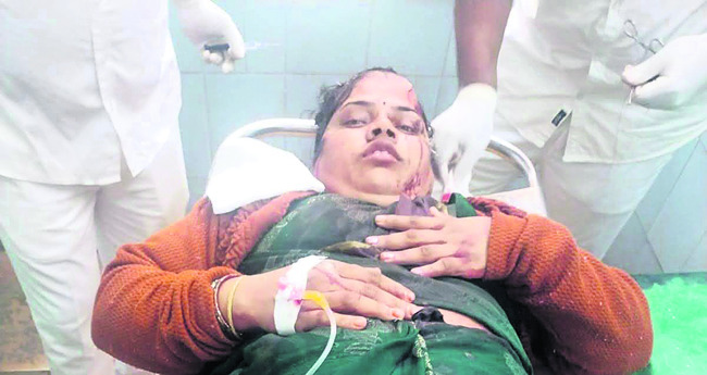 ఆర్టీసీ బస్సులో నుంచి పడి మహిళకు గాయాలు   2