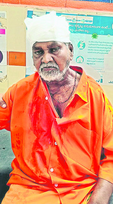 వేర్వేరు ప్రమాదాల్లో ఇద్దరికి గాయాలు 1