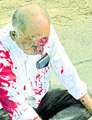 ఫ్లెక్సీ మీద పడి ఇద్దరికి తీవ్రగాయాలు 1