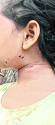 వసతి గృహ విద్యార్థినులపై కోతుల దాడి 1