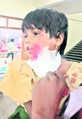 చిన్నారిపై పిచ్చికుక్క దాడి 
2