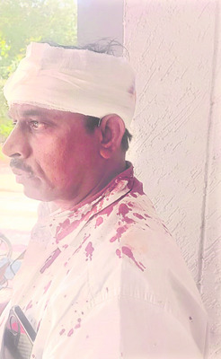 బాకీ చెల్లించమన్నందుకు దాడి 1