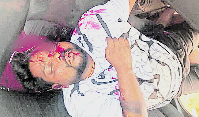 సిద్ధార్థ వైద్య విద్యార్ధుల అద్భుత ప్రతిభ 2