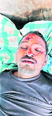 కొబ్బరి చెట్టు నుంచి  జారిపడి వ్యక్తి మృతి 1