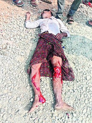 ట్రాన్స్‌పోర్ట్‌ కంటైనర్‌ను ఢీకొని స్కూటరిస్టు మృతి 1