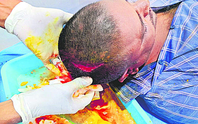 పల్నాడు1