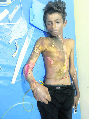 రోడ్డు ప్రమాదంలో ఒకరికి తీవ్రగాయాలు1