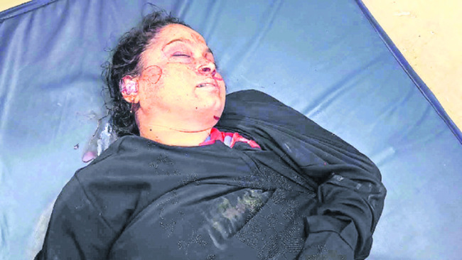 మోటార్‌బైక్‌ను ఢీకొట్టిన కారు1