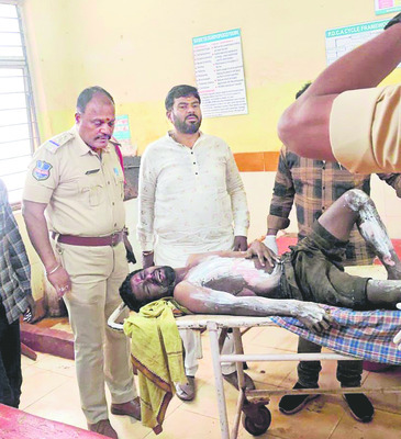 ఆపరేటర్‌ తప్పిదం.. లైన్‌మెన్‌కు విద్యుత్‌ షాక్‌1