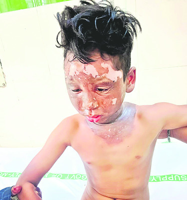 చేతికందేంత ఎత్తులో విద్యుత్‌ లైన్లు 1