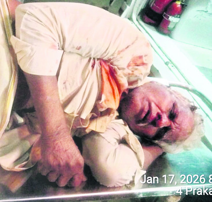 విద్యుత్‌ షార్ట్‌ సర్క్యూట్‌తో గుడిసె దగ్ధం 2