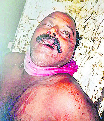 ‘పచ్చ’ మూకల బరితెగింపు 3