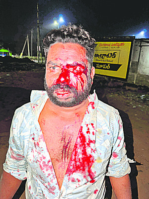 ప్రాణాలు తీస్తున్న మద్యం మత్తు3