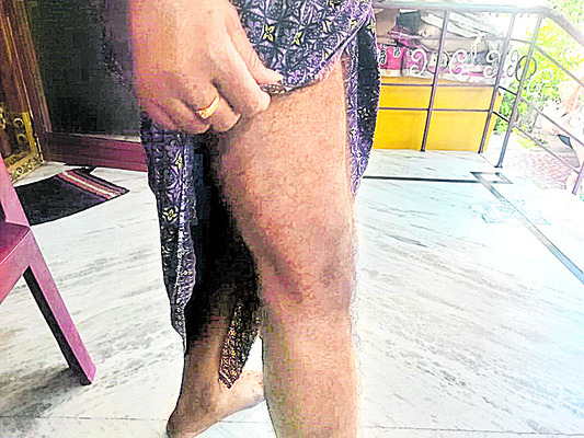 ‘పచ్చ’ మూకల బరితెగింపు 4