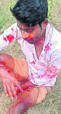 వేర్వేరు ప్రమాదాల్లో పలువురికి గాయాలు 1