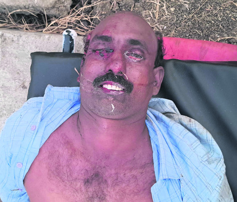 ఉండిలో వ్యక్తిది హత్యా? ఆత్మహత్యా?1