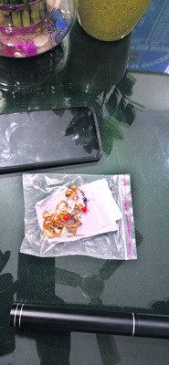 ఆభరణాల కోసం తల్లిపై కొడుకు దాడి1