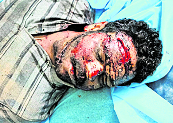 భార్య వద్దకు వెళ్తూ మృత్యు ఒడిలోకి.. 2