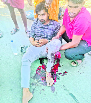 రోడ్డు ప్రమాదంలో  ఇద్దరికి గాయాలు  3