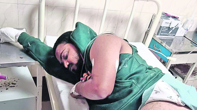 నంద్యాల ప్రమాదంలో సంగం వాసికి గాయాలు 1