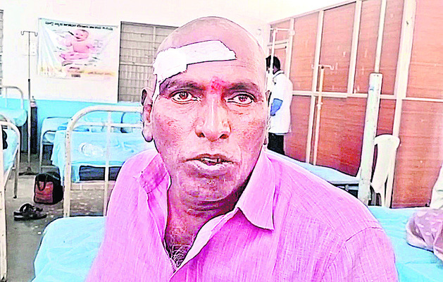 మేడారం భక్తులకు గాయాలు 2