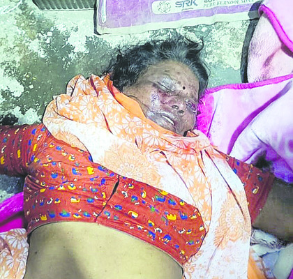 వేధింపులు భరించలేక  వ్యక్తి ఆత్మహత్య 
1