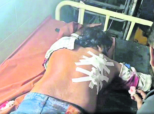 గొడవలో ముగ్గురికి కత్తిపోట్లు 
1