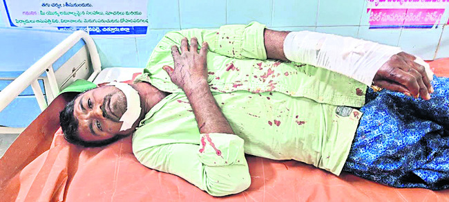 బైక్‌ ఢీకొని అన్నదమ్ములకు తీవ్రగాయాలు1