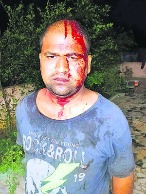 టీడీపీలో భగ్గుమన్న వర్గ విభేదాలు 1