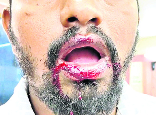 వామ్మో చైనా మాంజా!1