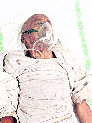 వేర్వేరు ప్రమాదాల్లో ముగ్గురికి గాయాలు2