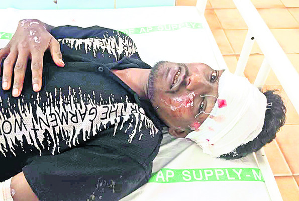 వేర్వేరు ప్రమాదాల్లో ముగ్గురికి గాయాలు1