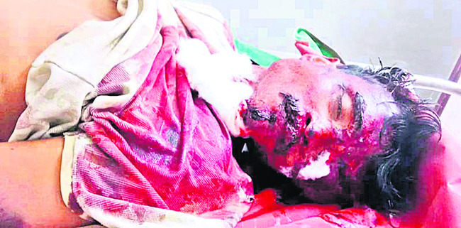 ఎస్సీ, ఎస్టీ అట్రాసిటీ కేసు విచారణ 
1