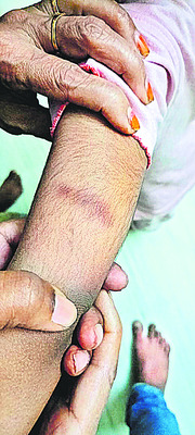 చిన్నారిని చితకబాదిన టీచర్‌, ఆయా 1