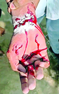 వీధికుక్క దాడి.. ఆరుగురికి గాయాలు 1