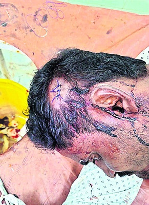 తల్లీకుమారుడిపై కత్తితో దాడి 1