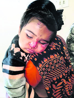 రైతు కుటుంబంపై చిరుత దాడి1