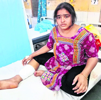 కాలేజీ బస్సును ఢీకొట్టిన లారీ 3