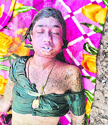 చికిత్స పొందుతూ ఏఎన్‌ఎం మృతి 1