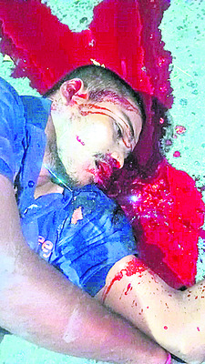 నిండు ప్రాణాన్ని బలిగొన్న నిర్లక్ష్యం 3