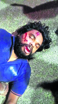 నిండు ప్రాణాన్ని బలిగొన్న నిర్లక్ష్యం 2