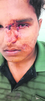 ఏపీఆర్‌జే కళాశాలలో విద్యార్థుల ఘర్షణ 1