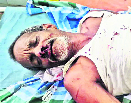 రోడ్డు ప్రమాదంలో  స్కూటరిస్టుకు తీవ్ర గాయాలు 1