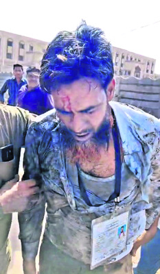 స్వల్ప ఉద్రిక్తతలు 3