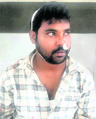 భూవివాదంలో ముగ్గురిపై టీడీపీ నాయకుల దాడి2