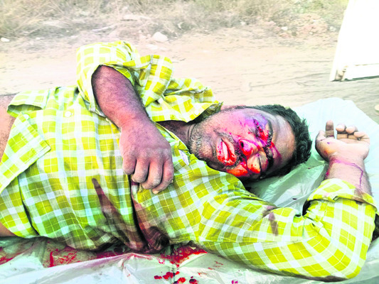 బైక్‌ల ఢీ : ఒకరిమృతి1